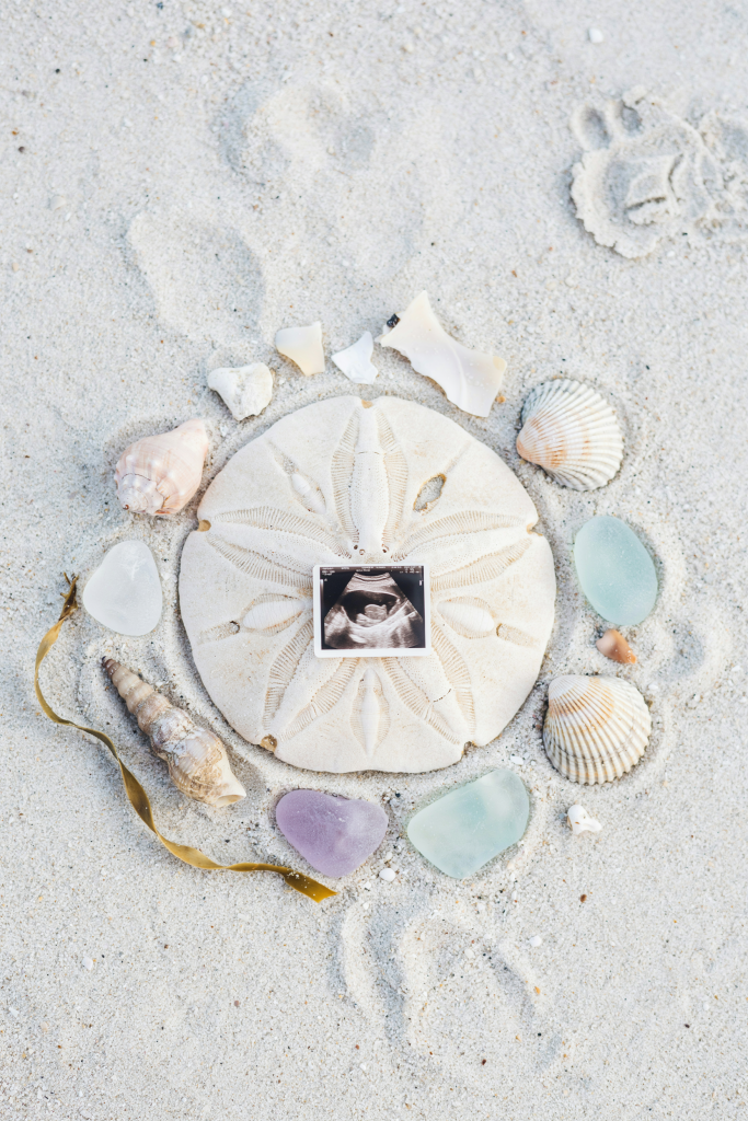 A close-up flat-lay of a sonogram photo nestled inside a large sand dollar, surrounded by tiny shells and sea glass on bleached white sand. Shot from directly above. Soft natural light. No text overlay — the image itself says everything.